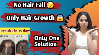 Hair fall treatment for men and woman | Hair fall | Hair loss 😱 | @ParulChoudhary1986