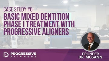 Case Study #6: Basic Mixed Dentition Phase I Treatment with Progressive Aligners | Dr. McGann