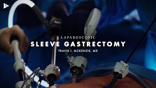 Laparoscopic Sleeve Gastrectomy by Travis J. McKenzie, MD | Preview