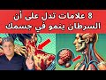 8 علامات مبكرة مؤكده للسرطان في جسمك وانت لا تعلم ما هي اعراض السرطان التحذيرية المبكرة 8 علامات مبكرة مؤكده للسرطان في جسمك وانت لا تعلم ما هي اعراض السرطان التحذيرية المبكرة