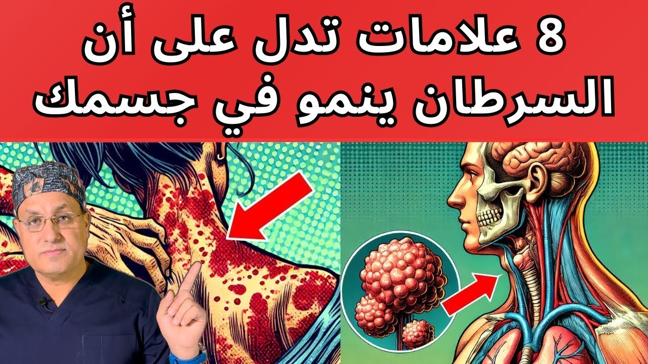 8 علامات مبكرة مؤكده للسرطان في جسمك وانت لا تعلم / ما هي اعراض السرطان التحذيرية المبكرة