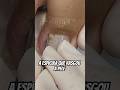 A dor dela acalmou depois disso #satisfying #shorts