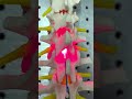 Successful Laser Spine Surgery by Dr. Kasinath Swain | Odisha’s Renowned Spine Surgeon