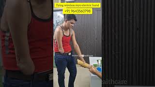 wireless myo hand nakli hayh hand prosthesis amputeelife amputeestrong sigma aura viral shorts