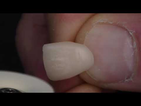 Polishing VITA ENAMIC®