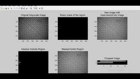 real time distance measurement and pixel count in matlab