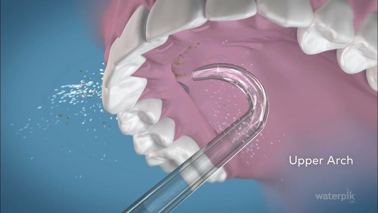 Waterpik® Implant Denture Tip (UK) YouTube