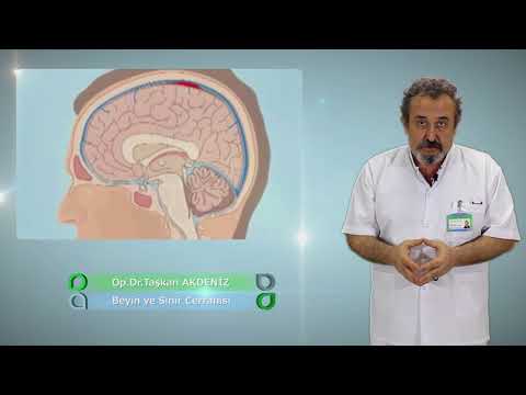 Video: Hematoma - Traumatisku Un Intrakraniālu Hematomu Cēloņi Un Simptomi