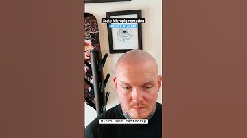 Session 3 #smp #scalpmicro #scalpmicropigmentation #smptraining #edmonton