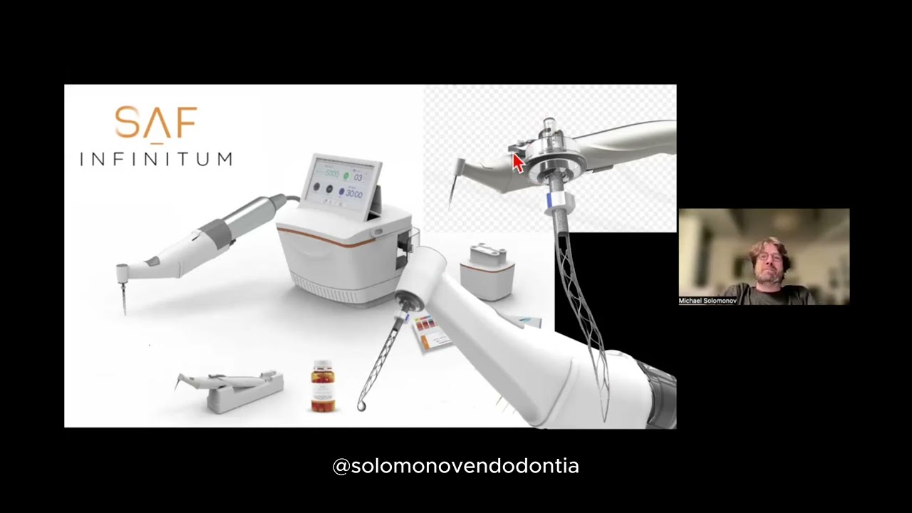 SAF нового поколения: фрагмент вебинара по работе с C-shape каналами