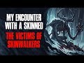 "My Encounter With A Skinned, The Victims Of Skinwalkers" Creepypasta