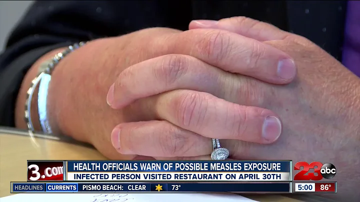 Health officials warn of possible measles exposure
