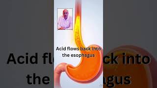 1 Common Mistake That Causes Heartburn After Meals #healthyliving #healthylifestyle #facts