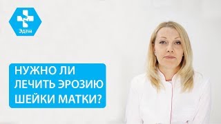 👩 Что такое эктопия шейки матки, и когда необходимо ее лечить. Эктопия шейки матки лечение. 12 👩 Что такое эктопия шейки матки, и когда необходимо ее лечить. Эктопия шейки матки лечение. 12
