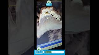 ✨ Advanced Imaging with Cone Beam Computed Tomography (CBCT)  #healthysmile #dentalcare