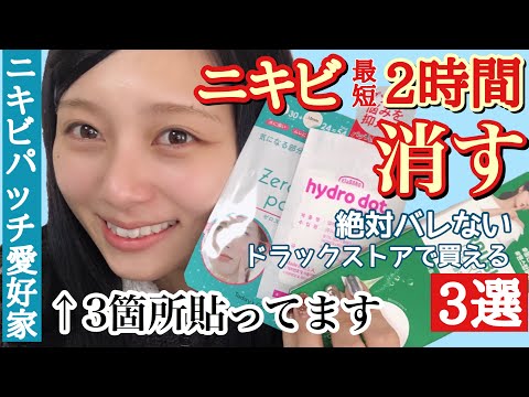 【ニキビをなかったことに】 隠しながら２時間でなおす強力ニキビパッチ・絶対バレないニキビパッチ・日本で買えるニキビパッチお気に入り３選！【スキンケア紹介】