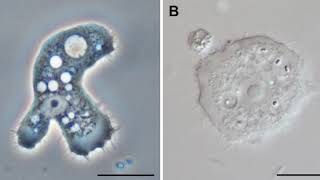 Stygamoebidae | Wikipedia audio article