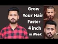 How To Grow Your Hair Faster And Longer Naturally At Home | Grow Your Hair Fast 4 Inch In A Week