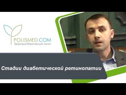 Стадии диабетической ретинопатии: непролиферативная, препролиферативная, пролиферативная