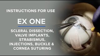 BIONIKO EX ONE (EX1) IFU.  Trabeculectomy, strabismus, injections, buckle, corneal trauma and more