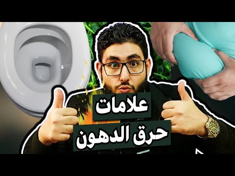 علامات حرق الدهون بدون ميزان أول علامات نزول الوزن