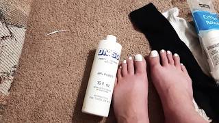 More Dmso On My Broken Foot.. Here We Go
