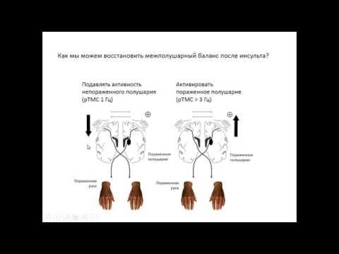 Видео: Диагностика и ведение преинвазивных заболеваний молочной железы: роль новых методов диагностики