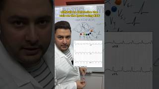 ECG - Axis EXPLAINED 🤓🤯 #ecg #cardiology #medicaleducation #medicalstudent #futuredoctor #osmosis