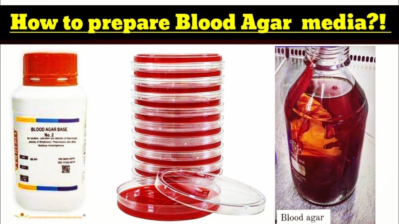 Blood Agar Preparation | Blood agar Media Preparation procedure # ...