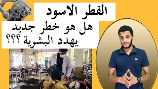 الفطر الاسود  . كل ما تريد معرفة عن الفطر الاسود