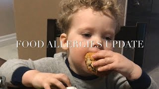 WHY I GIVE MY ALLERGIC SON EGGS // FOOD ALLERGIES // ORAL FOOD CHALLENGE