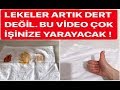 LEKELER ARTIK DERT DEĞİL! BU YÖNTEMİ ÇOK SEVECEKSİNİZ