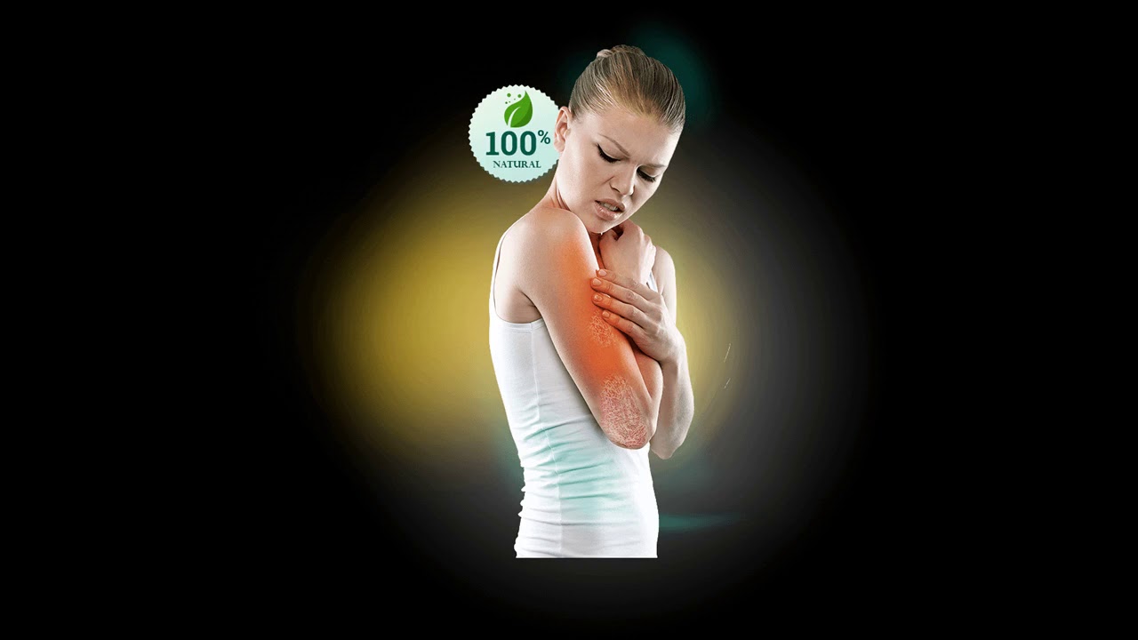 varikosette gel - my varicose vein story - all your questions answered!