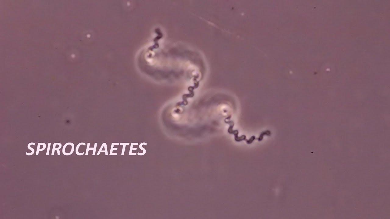 Spirochetes seen through a compound microscope YouTube