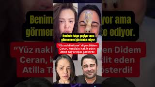 Yüz Nakli Olduğunu Açıklayan Didem Ceran, Kendisini Taklit Eden Atilla Taşa Tepki Gösterdi