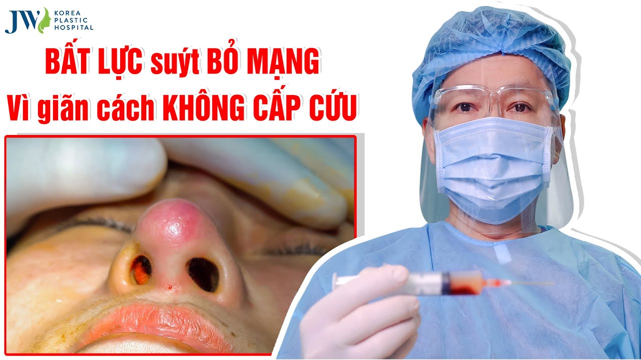 tham my vien ngoc yen ca mau New Update Xém BỎ MẠNG vì BIẾN CHỨNG THẨM MỸ mùa COVID, CẦU CỨU ai đây?