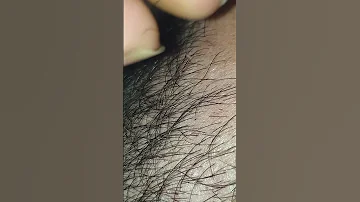Ingrownhair Satisfying Hair Remove Asmr Hairstyle Trending Oddlysatisfying Waxing 