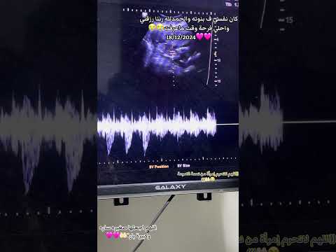 ادعولهادعوه حلوه يارب ارزق كل مشتاق وقر عينهم بطفل سالم معافي يارب Trending Facts Facts ادعولهادعوه حلوه يارب ارزق كل مشتاق وقر عينهم بطفل سالم معافي يارب Trending Facts Facts