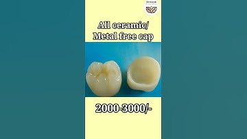 Thumbnail of Types of dental caps/crown and cost