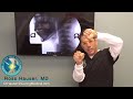 Importance of the cervical spine curve- DMX review of tinnitus and headache case