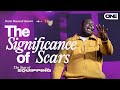 The Significance of Scars - Roosevelt Stewart