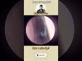 @귀지형 #콧물 #부비동염 #축농증 #비염 #코청소 #이비인후과 #rhinorrhea #rhinitis #sinusitis #ASMR