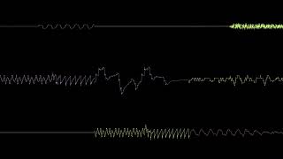 Vortex - LMAN (ZylX050V2 Cover)