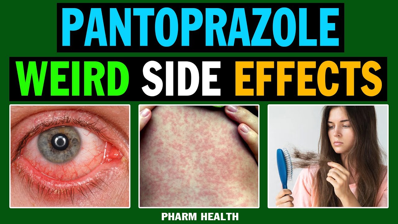 8 Weird and Unexpected Side Effects of Pantoprazole (Skin, Infections, Nutrient Deficiencies).