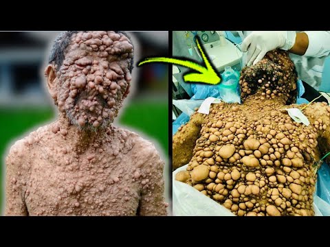 The Most Unusual People With Bizarre Skin Conditions