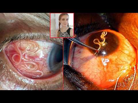 27 Bizarre Medical Stories