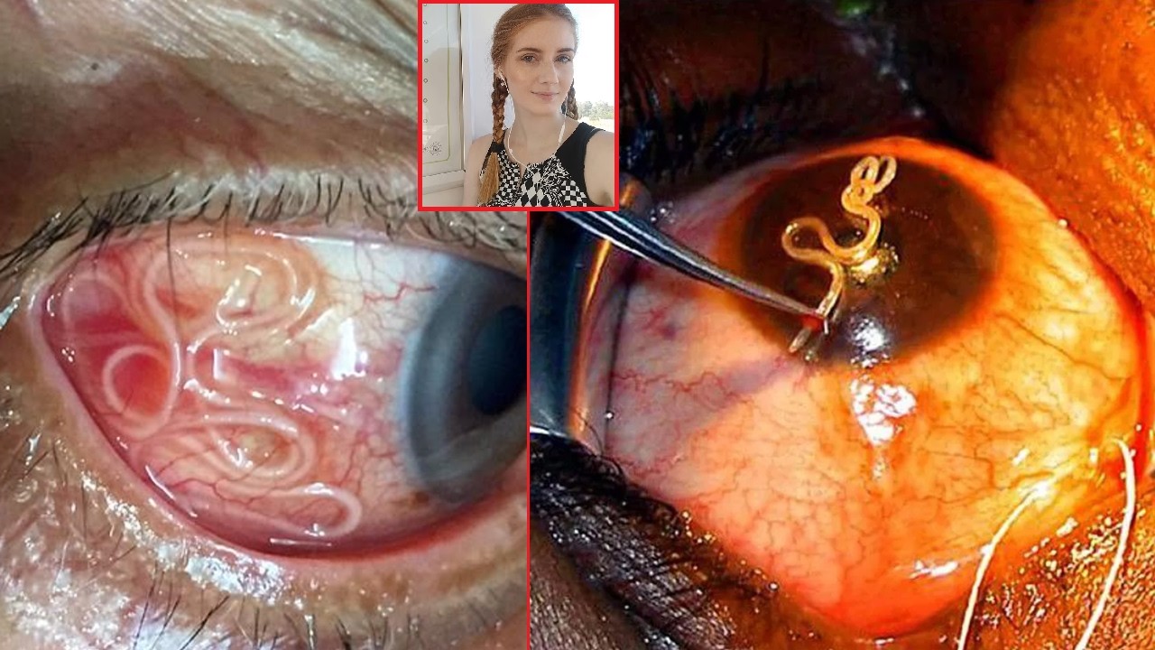 27 Bizarre Medical Stories - YouTube