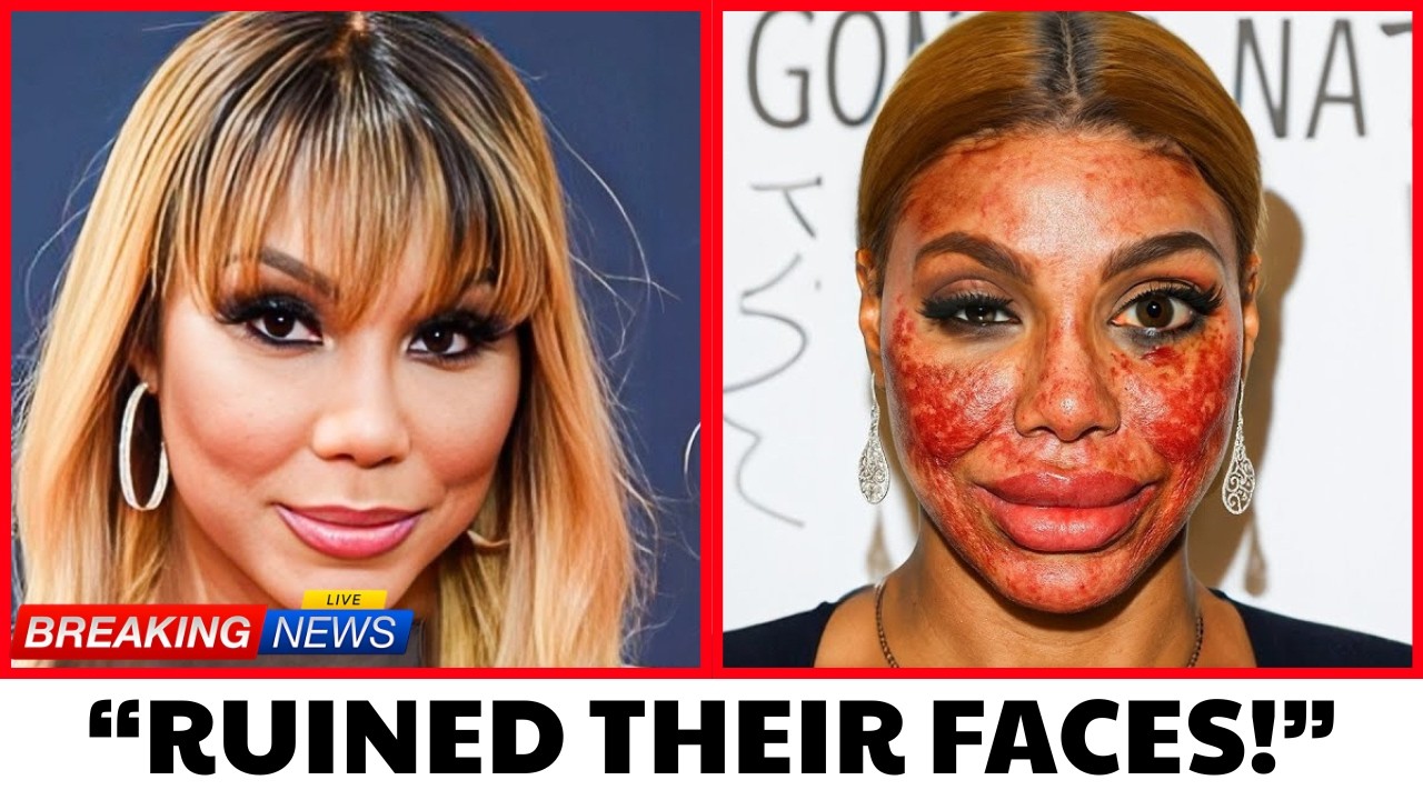 R&B Icons Most UNBELIEVABLE Plastic Surgery Transformation
