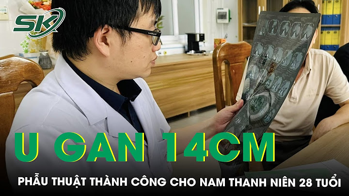 Gan bị nổi nhiều khối u là bệnh gì năm 2024