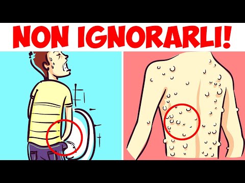 Video: 9 Sintomi Che Sono Pericolosi Da Ignorare